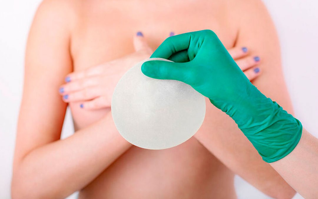 Conoce la evolución de los implantes mamarios y cuál es el mejor